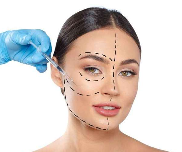 Harmonização Facial